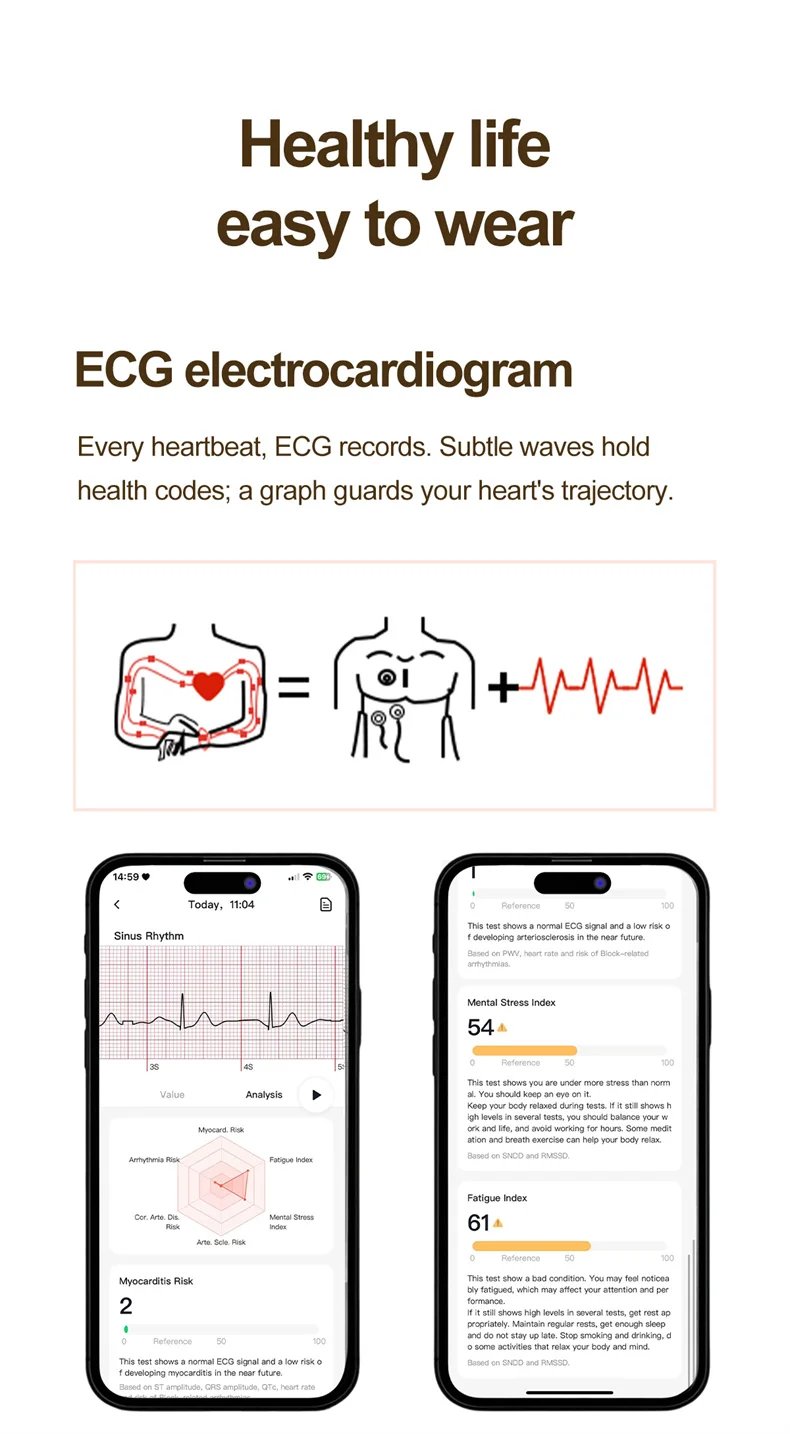 Women Smartwatch 1.32inch AMOLED Screen Call ECG Sport Watch Blood Pressure Micro physical examination AI dial Women Smart Watch