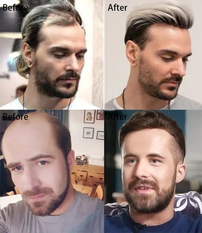 0.12-0.14mm Injected Thin Skin 130%Density Man Hair Prosthesis Human Hair Male Toupee Wig Adult Capillary Prosthesis Hair System